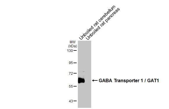 GAT-1/SLC6A1 Antibody - BSA Free