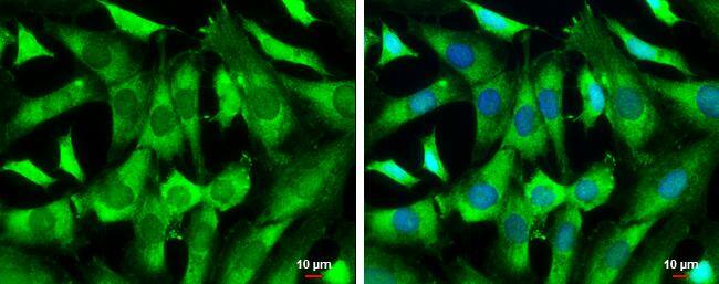WASF1/WAVE1 Antibody - BSA Free
