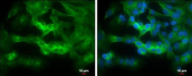 STRN4 Antibody