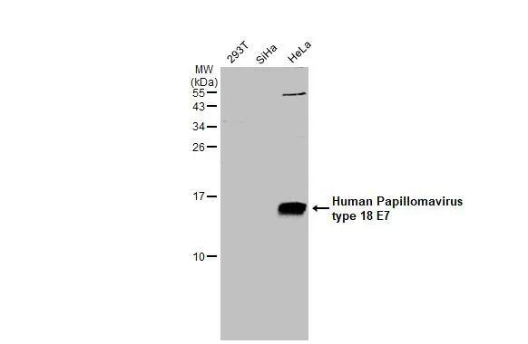 HPV18 E7 Antibody - BSA Free