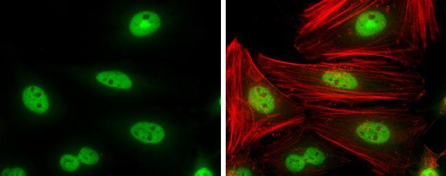 Cyclin T1 Antibody - BSA Free
