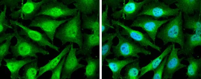 Cyclin D2 Antibody - BSA Free