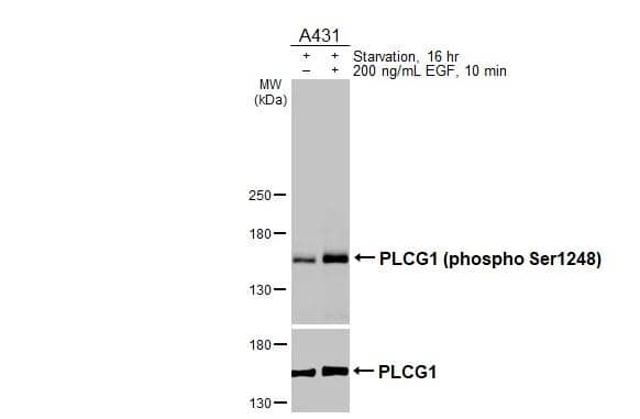 PLC-gamma 1 [p Ser1248] Antibody