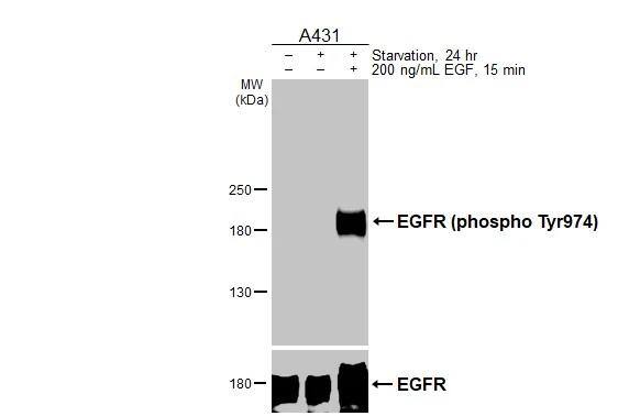 EGFR [p Tyr998] Antibody