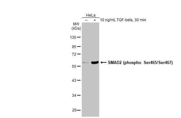 Smad2 [p Ser465, p Ser467] Antibody