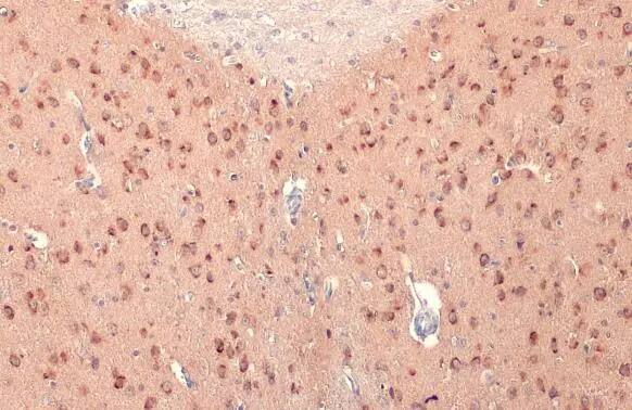 RASGRF1 Antibody