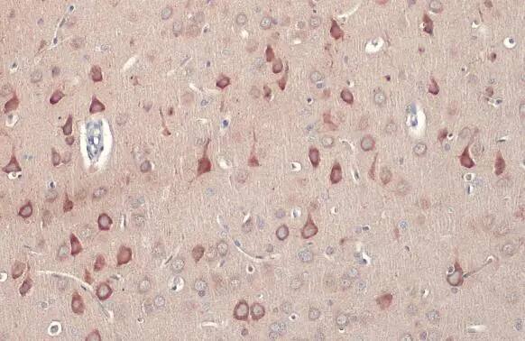 RASGRF1 Antibody