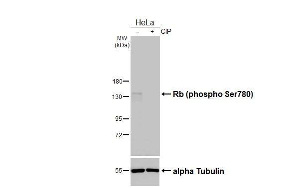 RB1 [p Ser780] Antibody