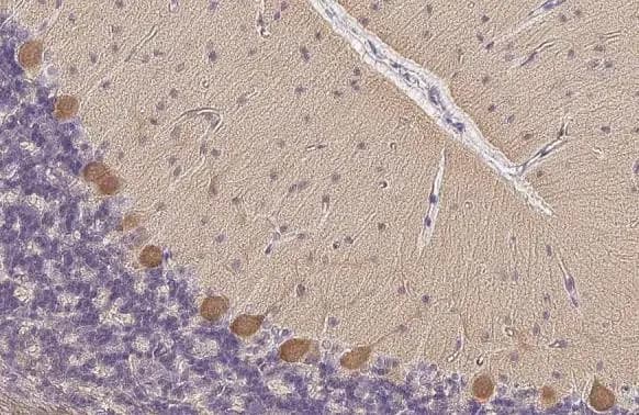 PKC zeta [p Thr410] Antibody