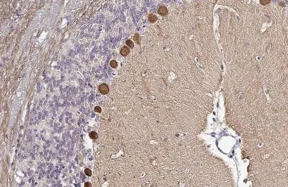 PKC zeta [p Thr410] Antibody