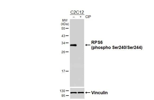 Ribosomal Protein S6/RPS6 [p Ser240, p Ser244] Antibody
