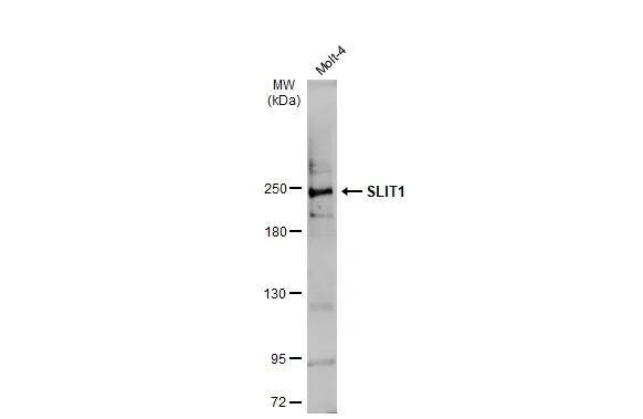 Slit1 Antibody - BSA Free