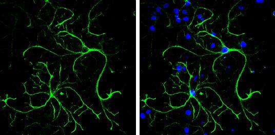 alpha Desmuslin Antibody