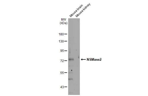SMPD3/NSMase2 Antibody