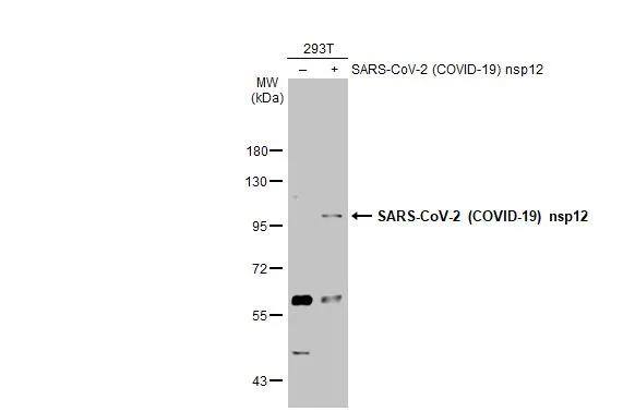 SARS-CoV-2 nsp12 Antibody - BSA Free