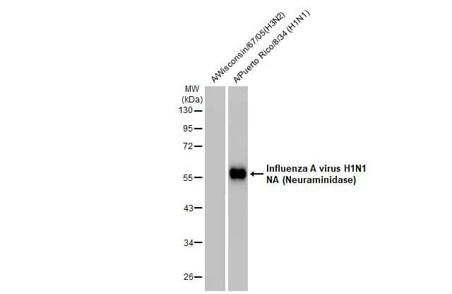Influenza A H1N1 Neuraminidase Antibody (GT172) - (A/WSN/1933)