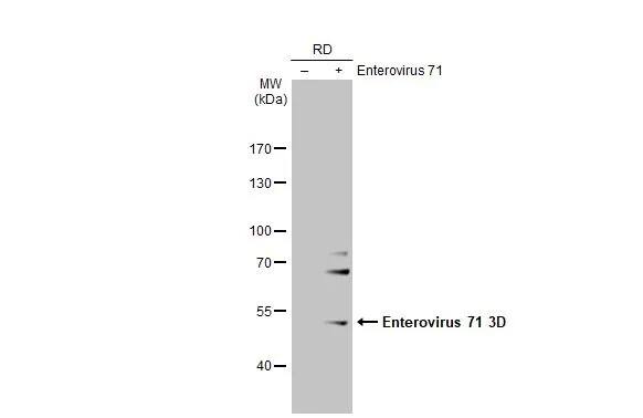 Enterovirus 71 3D Antibody (4)