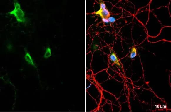 C9orf72 Antibody (779)