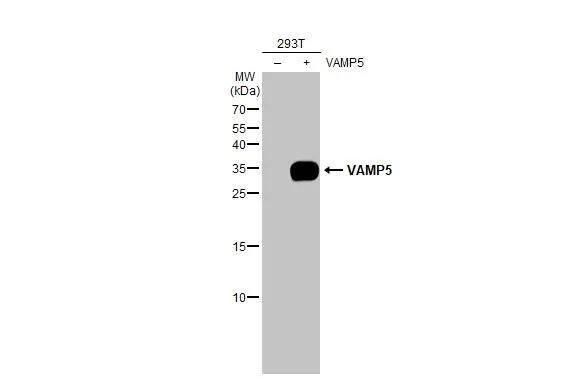 VAMP-5 Antibody (3E5)