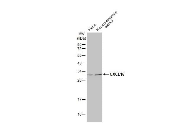 CXCL16 Antibody (GT516)