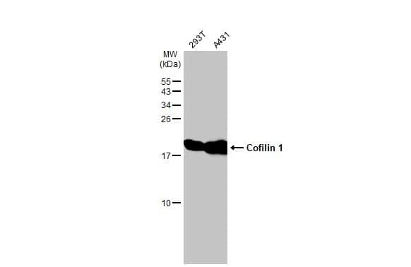 Cofilin Antibody (GT217)