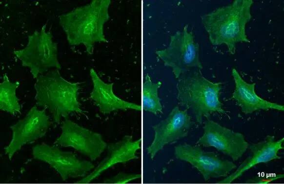 Cofilin Antibody (GT217)