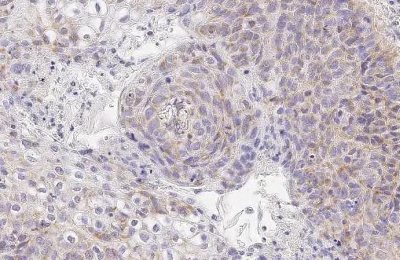 SDHA Antibody (GT20710)