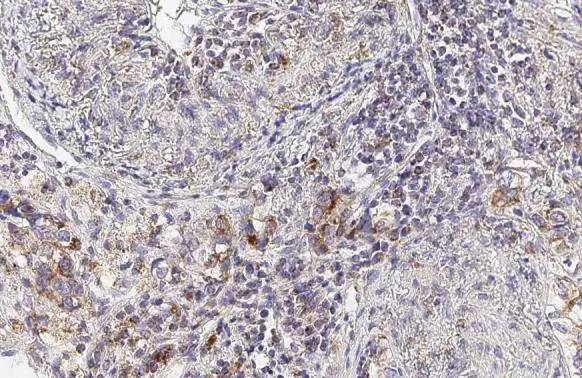 SDHA Antibody (GT20710)