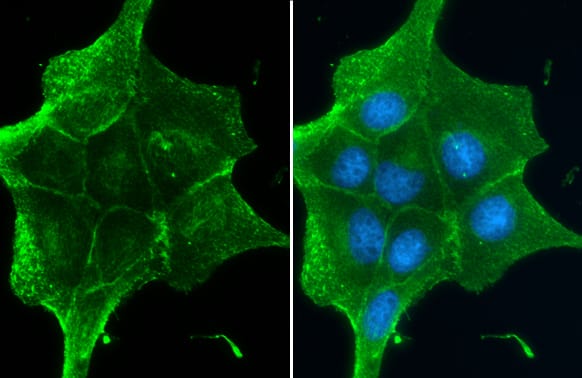 beta-Catenin Antibody (GT2169)