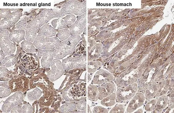 non-muscle Myosin IIA Antibody (GT218)