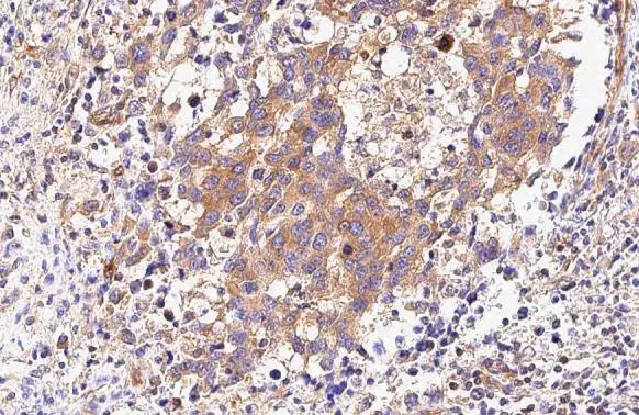 non-muscle Myosin IIA Antibody (GT218)