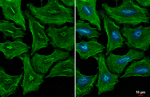 non-muscle Myosin IIA Antibody (GT218)