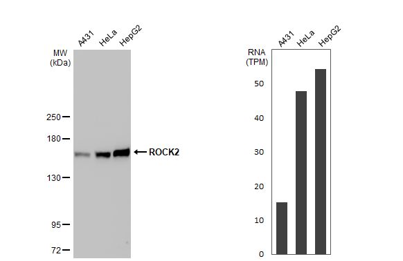ROCK2 Antibody (GT11712)