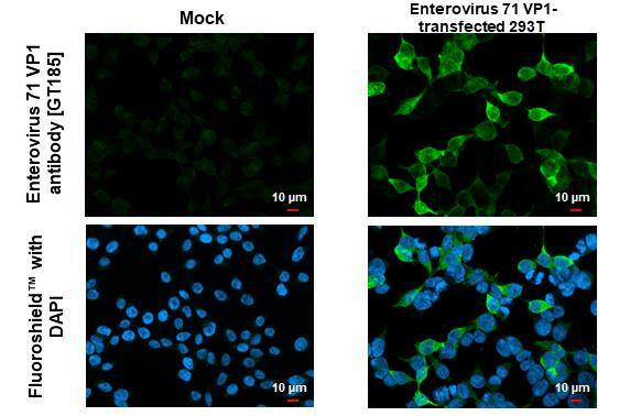 Enterovirus 71 VP1 Antibody (GT185) - Azide and BSA Free