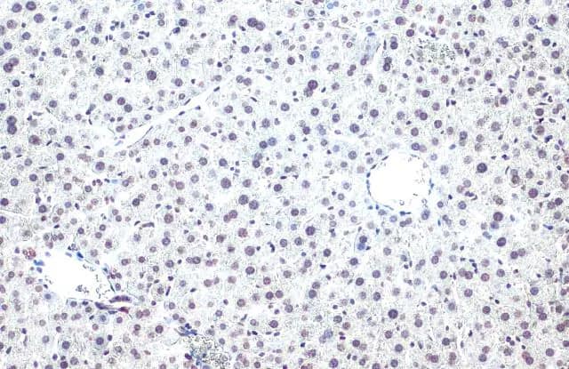 Histone H2B [ac Lys20] Antibody (GT578)