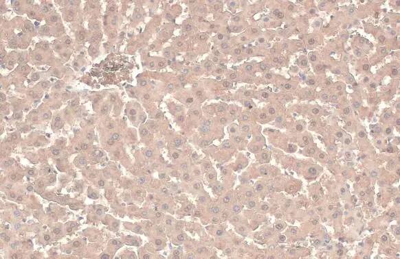 ATP6V1A Antibody (GT811)