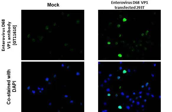 Enterovirus D68 VP1 Antibody (GT11610) - Azide and BSA Free