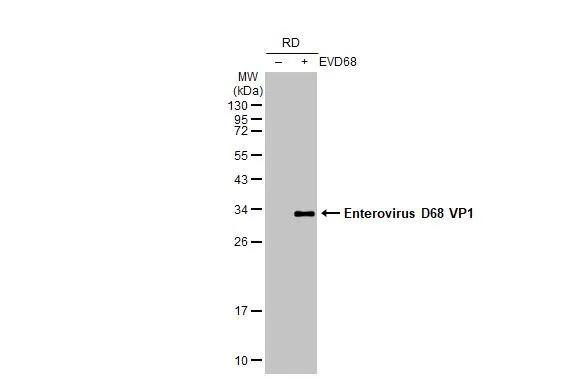 Enterovirus D68 VP1 Antibody (GT11610) - Azide and BSA Free