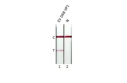 Enterovirus D68 VP1 Antibody (GT1843)