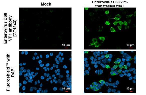 Enterovirus D68 VP1 Antibody (GT1843) - Azide and BSA Free
