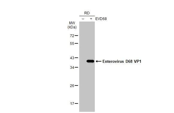 Enterovirus D68 VP1 Antibody (GT1843) - Azide and BSA Free