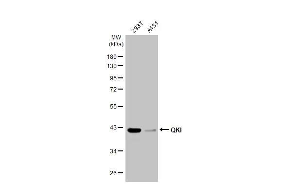 QKI/Quaking Antibody (GT2612)