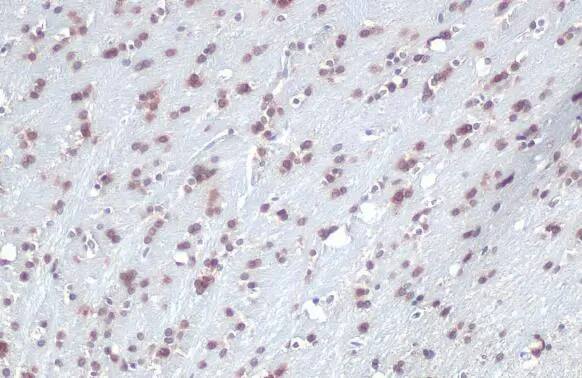 QKI/Quaking Antibody (GT228)