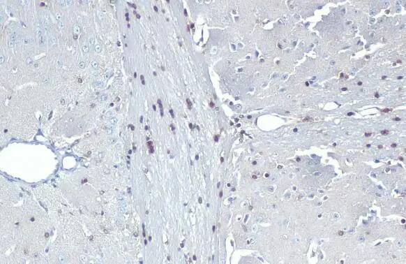 QKI/Quaking Antibody (GT228)