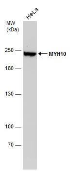 non-muscle heavy chain 10 Myosin Antibody (GT324) - Azide and BSA Free