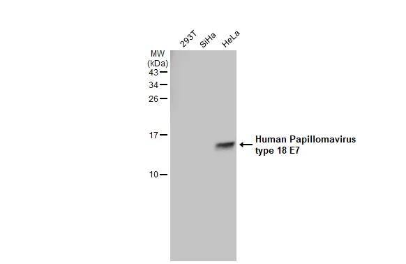 HPV18 E7 Antibody (GT881) - Azide and BSA Free