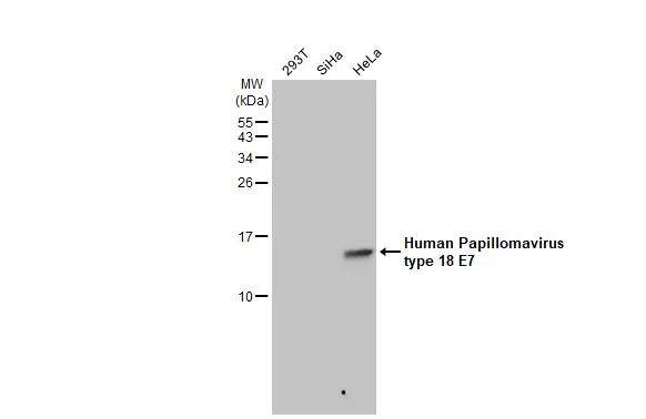 HPV18 E7 Antibody (GT881) - Azide and BSA Free