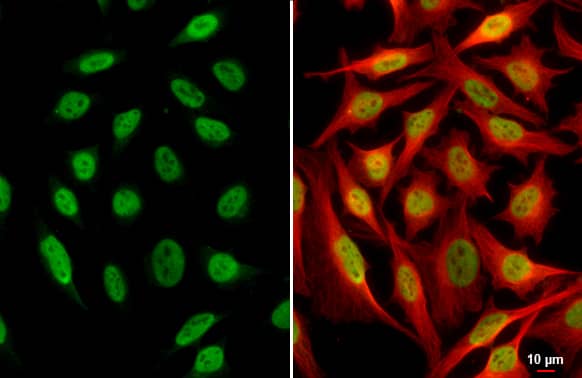 SP1 Antibody (GT2574)