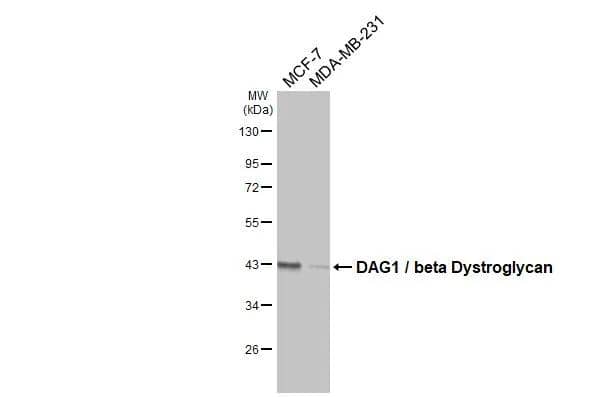 Beta Dystroglycan Antibody (GT835) - Azide and BSA Free
