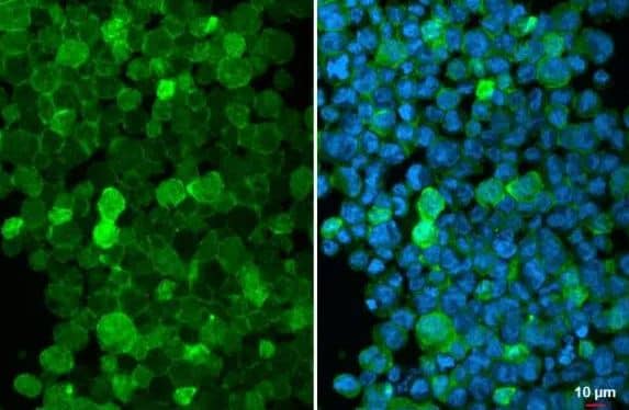 AIF-1/Iba1 Antibody (HL22)